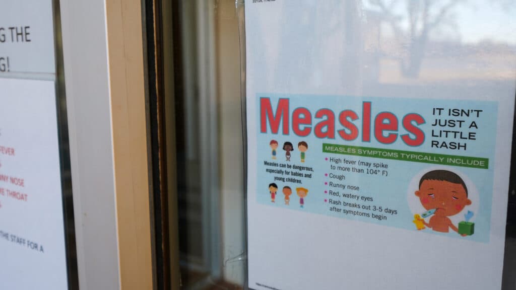 U.S. Records Highest Measles Deaths in Decades