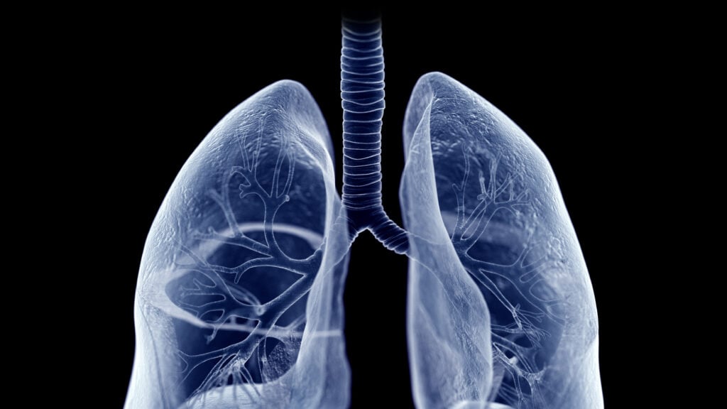 Roivant's Lung Disease Drug Achieves Mid-Stage Study Goals