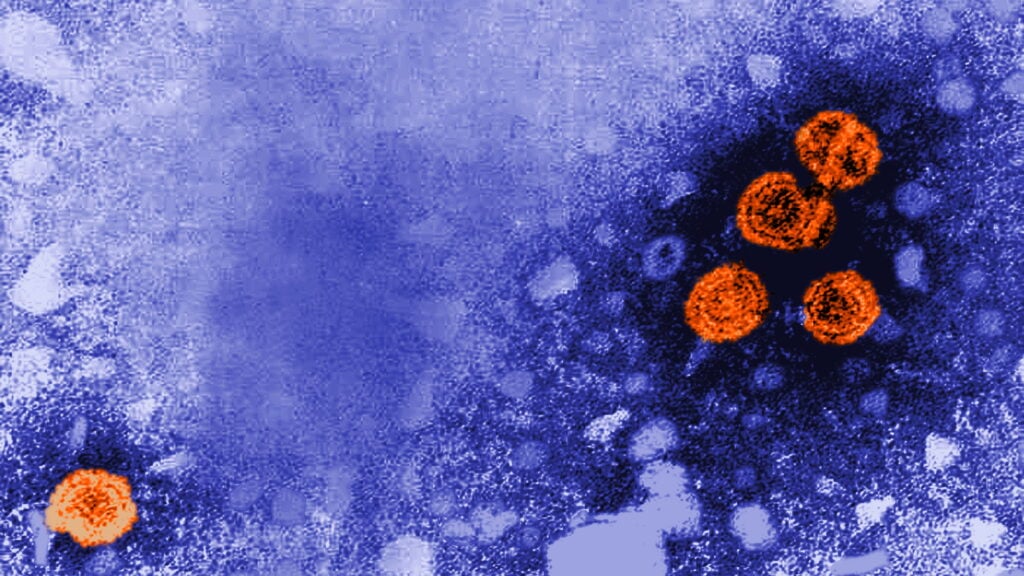 GSK Obtiene Aprobación de la FDA para su Medicamento contra la Hepatitis B con Cura Funcional Extendida