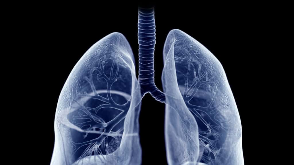 Roivant's Lung Disease Drug Achieves Mid-Stage Study Goals