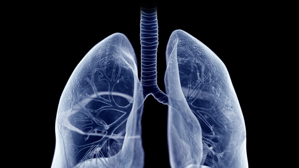 Roivant's Lung Disease Drug Achieves Mid-Stage Study Goals