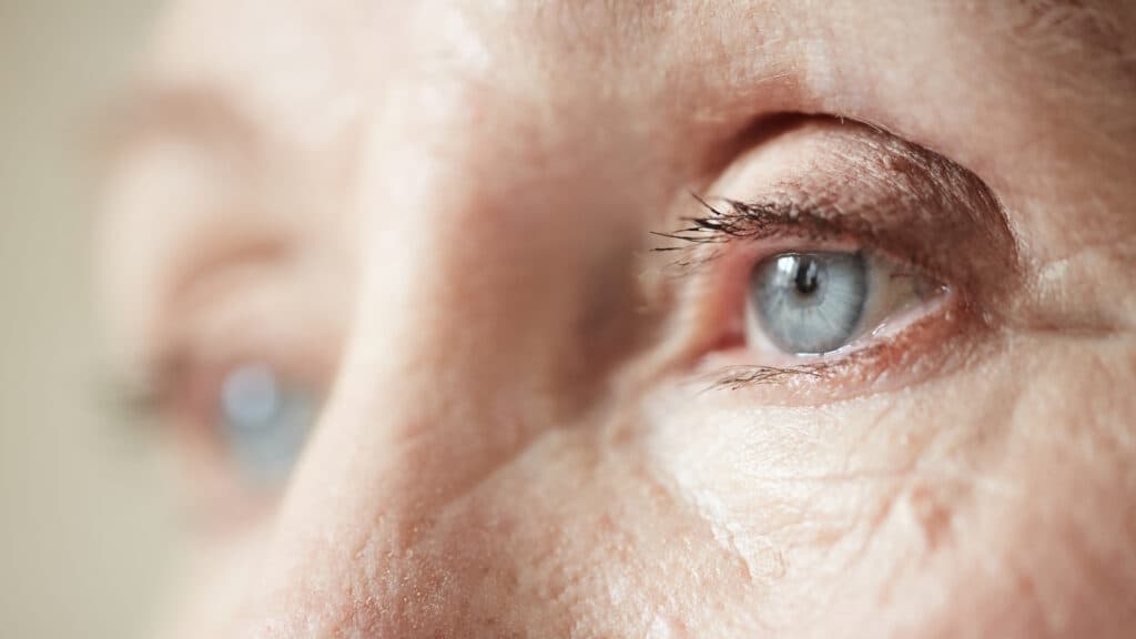 Eyepoint study results for vision treatment disappoint, but company still sees promise