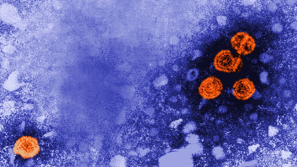 GSK Obtiene Aprobación de la FDA para su Medicamento contra la Hepatitis B con Cura Funcional Extendida